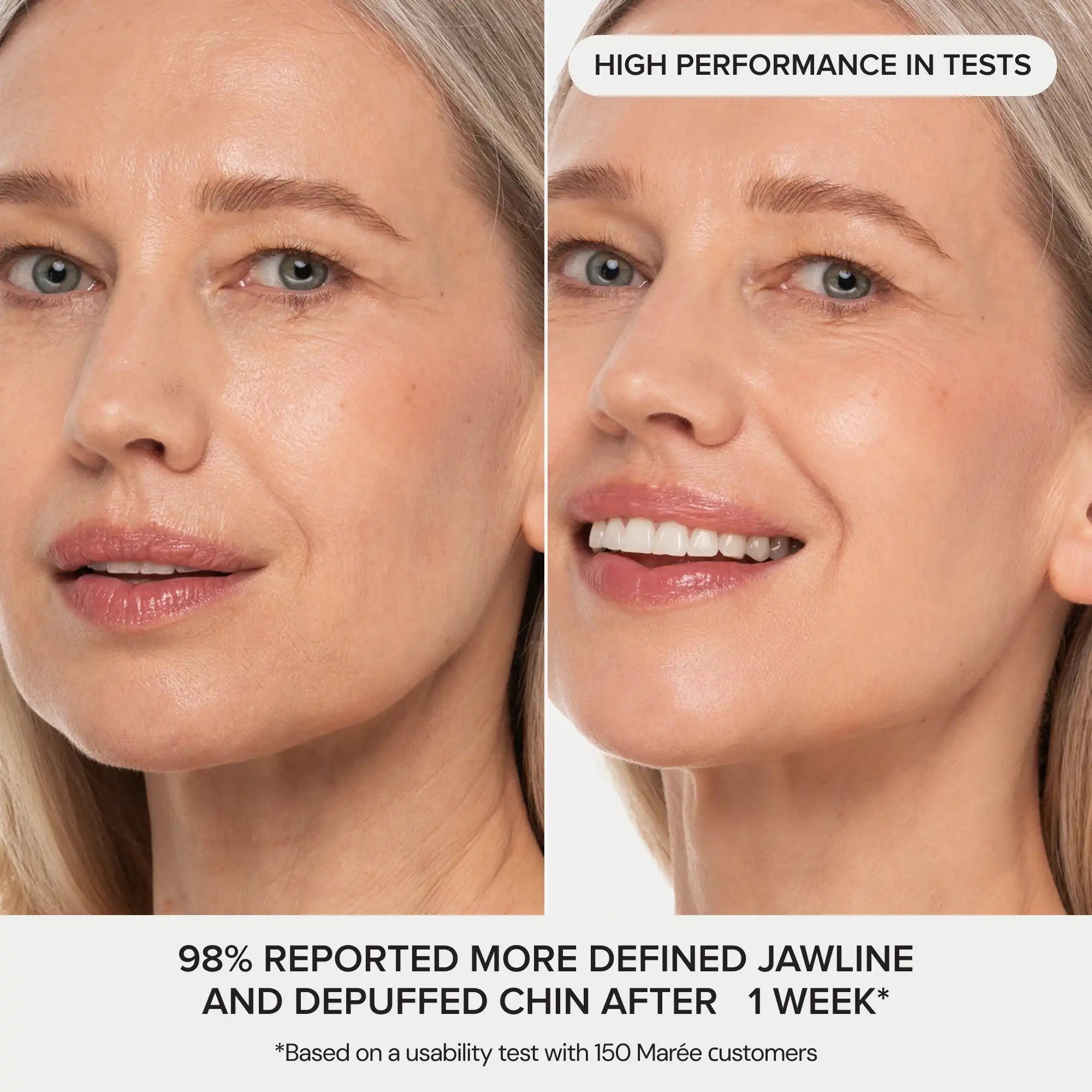 24K Gold V-Line Lifting Mask